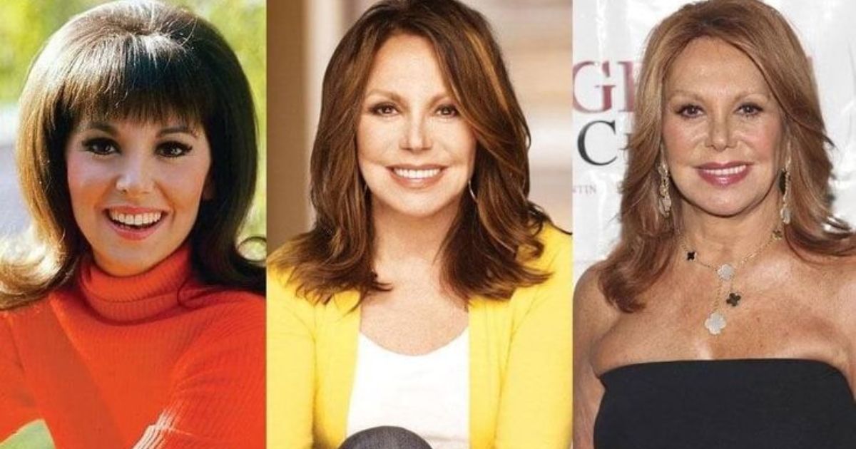 marlo-thomas-plastic-surgery-–-before-and-after-pictures